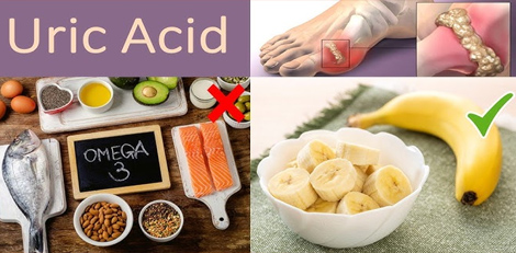 List of various health problems we can get if we have high uric acid, take care!!