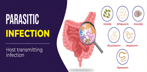 If you have a parasitic worm infection, then you will show these important signs, take care!!